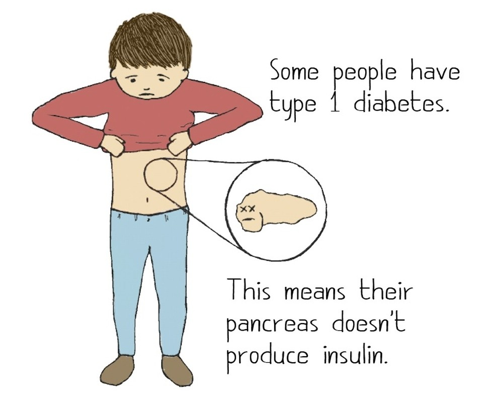 Unravelling the Causes of Type 1 Diabetes