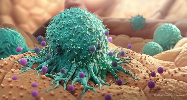 Pancreatic cancer and ways of treating it